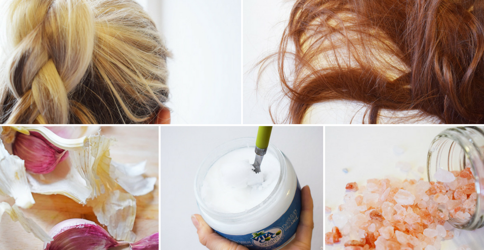 Dandruff dilemma: find a dandruff cure that WORKS today!