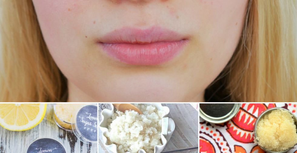 How to fix chapped lips FAST causes & treatments for SUPER dry lips